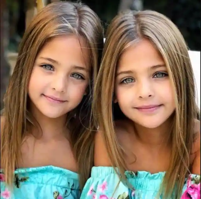 This is What The World’s Most Beautiful Twins Look Like Today