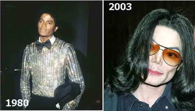 Top 20 Of The Worst Celebrity Plastic Surgeries. They Will Shock You!