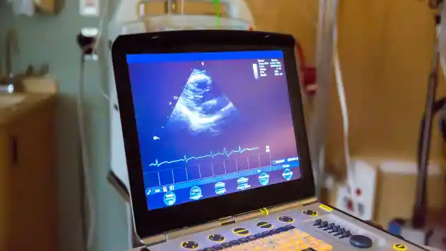 Ultrasound Image 