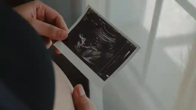 The First Ultrasound