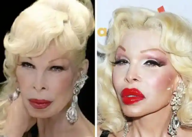 With the Help of A.I., Here's How These Celebrities Would Look Without Plastic Surgery