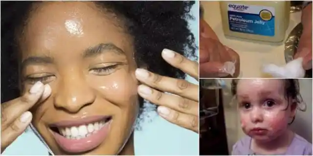 Vaseline: Surprising Uses for this Wonder Jelly