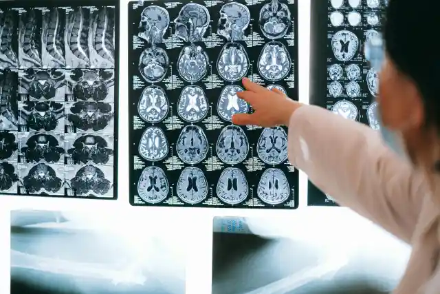 Recognizing Early Symptoms of Alzheimer’s Disease