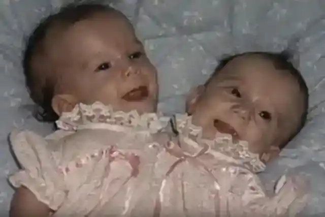 Parents Decided Not To Have Them Separated