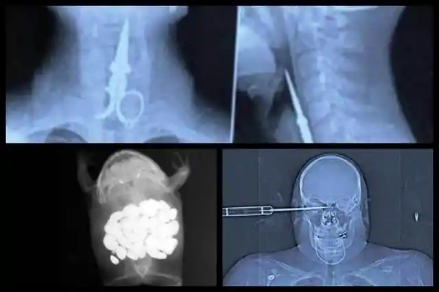 “How Did That Get In There?” A Cross-Section Of X-traordinary X-Rays Found Online