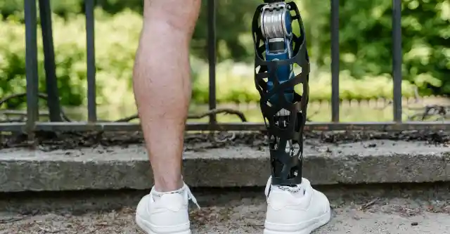 Behind the Prosthetic
