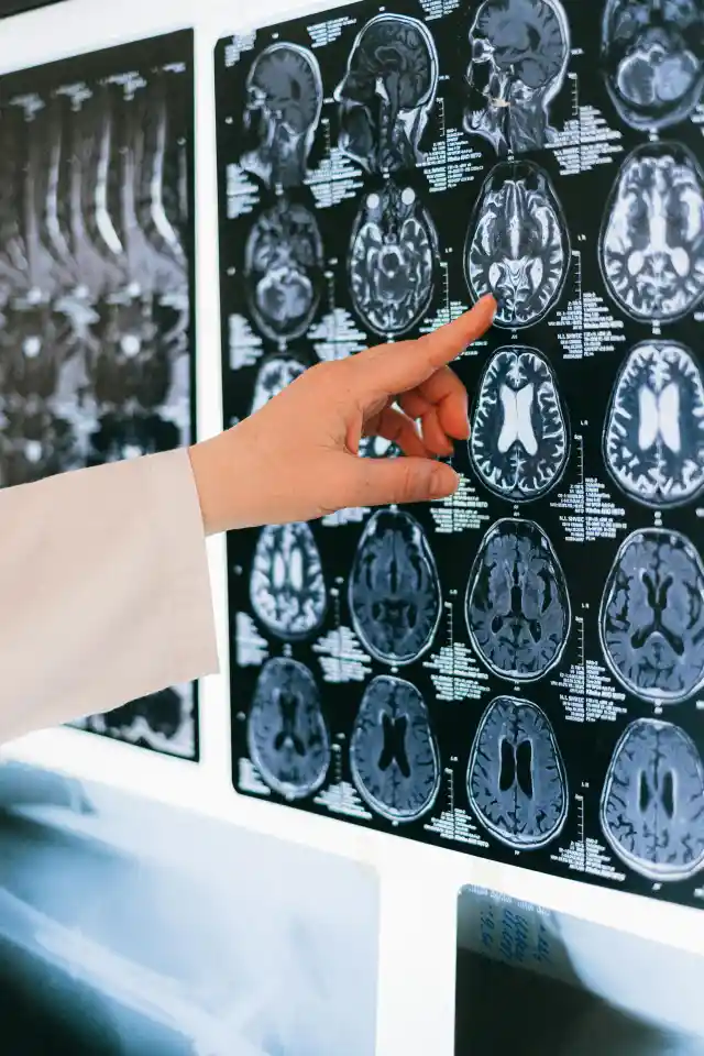 Four Initial Indicators Of Alzheimer’s Disease