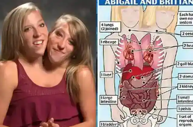 They Share Some (Not All) Organs