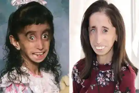 Lizzie Velásquez – Born in 1989