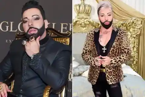 Harald Glööckler – 20 Kilogramm