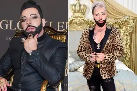 Harald Glööckler – 20 kilograms