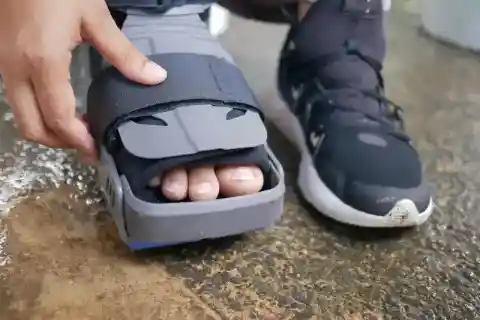 발가락 통증