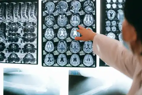 Recognizing Early Symptoms of Alzheimer’s Disease