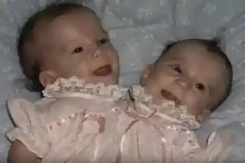 Parents Decided Not To Have Them Separated