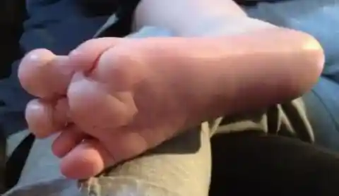 피부 과성장