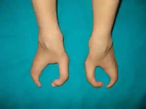 カギ爪のような手