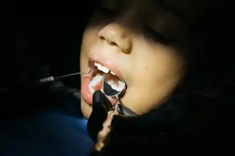 Inflammation Of The Gums