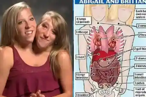 They Share Some (Not All) Organs